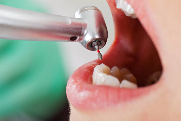Best Emergency Denture Repair in Hilliard, OH